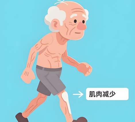 老年肌少症别只补钙！护士说这2个动作增肌更有效